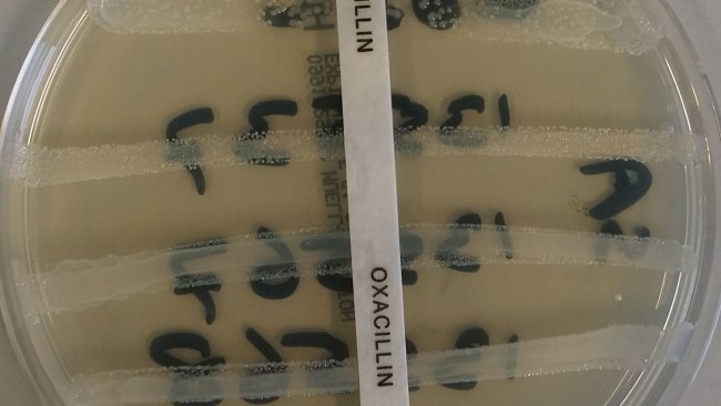 resistencia antimicrobiana