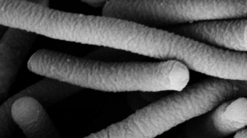 Foto 1. Micrografia eletr&ocirc;nica de Lactobacillus acidophilus, que possui caracter&iacute;sticas probi&oacute;ticas. Foto de Mogana Das Murtey e Patchamuthu Ramasamy.
