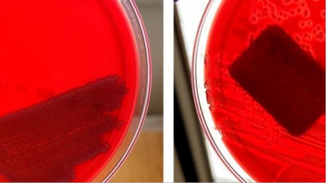 E. coli n&atilde;o hemol&iacute;tica (esquerda) e&nbsp;E. coli hemol&iacute;tica (direita)
