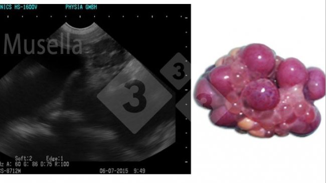 Figura 1. Corpo lúteo.