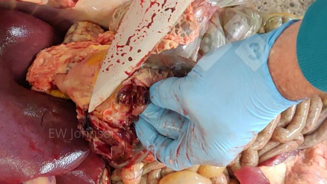 Foto 2. Hemorragia e necrose em linfonodo gastro-hepático.