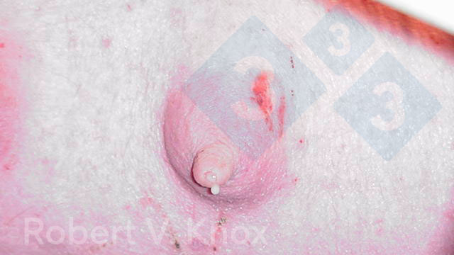 Colostro gotejando da glândula mamária