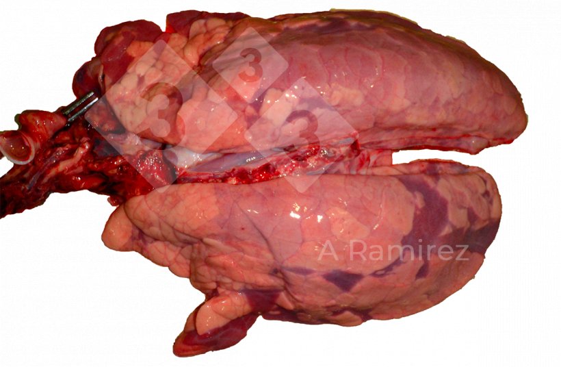 Figura 3:Infec&ccedil;&atilde;o por Influenza A de apresenta&ccedil;&atilde;o irregular e difusa com discreto edema interlobular.

