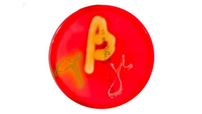Figura 1. Culturas de placa de Petri em &aacute;gar sangue mostrando hem&oacute;lise alfa, beta e gama. Fonte: Mibilehr https://creativecommons.org/licenses/by-sa/4.0/deed.ene&nbsp;
