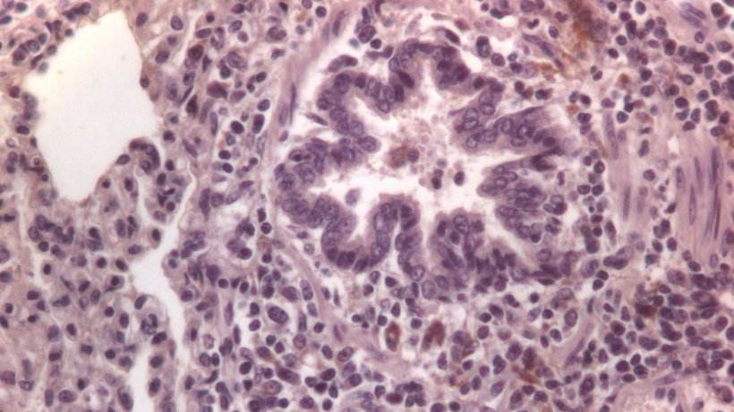 Figura 3: C&eacute;lulas imunomarcadas frente a PCV2 em pulm&atilde;o
