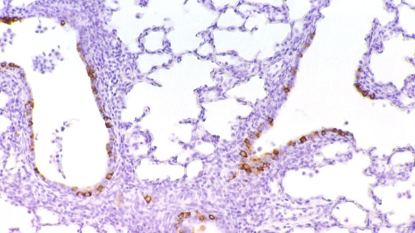 Figura 6: C&eacute;lulas imunomarcadas frente a PRCV no epit&eacute;lio bronquiolar
