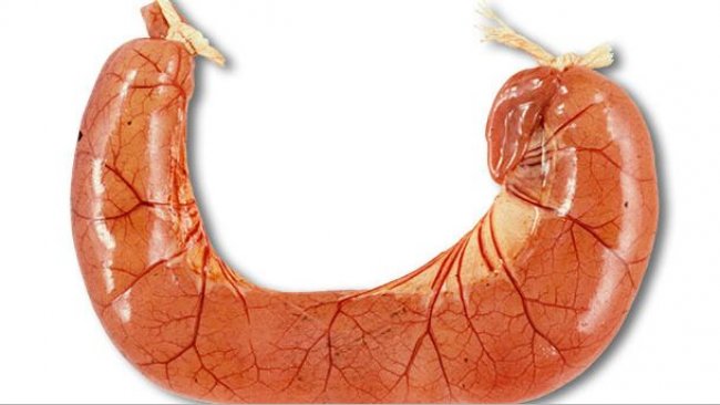 A necropsia dos casos de diarreia por&nbsp;ETEC geralmente mostra al&ccedil;as intestinais dilatadas, delgadas e congestionadas, cheias de diarreia aquosa amarela.
