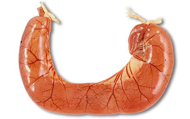 A necropsia dos casos de diarreia por&nbsp;ETEC geralmente mostra al&ccedil;as intestinais dilatadas, delgadas e congestionadas, cheias de diarreia aquosa amarela.
