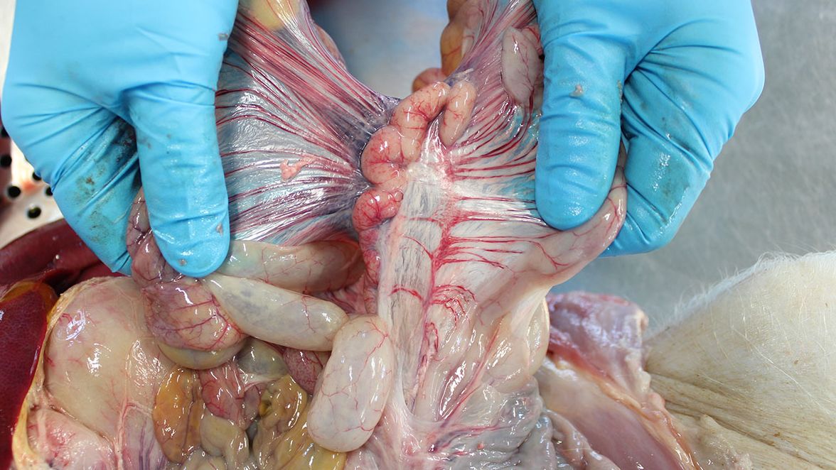 N&oacute;dulo linf&aacute;tico mesent&eacute;rico
