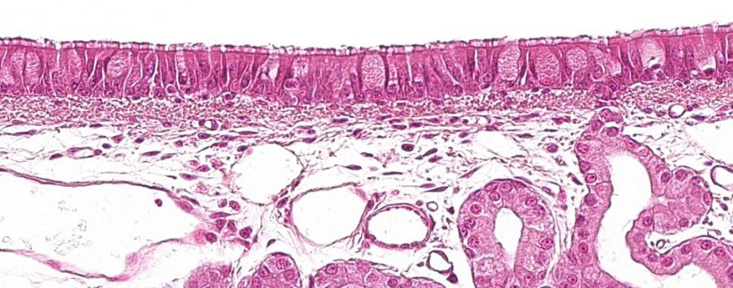 Figura 1: Epit&eacute;lio pseudo-estratificado ciliado com c&eacute;lulas caliciformes caracter&iacute;sticas do sistema respirat&oacute;rio.
