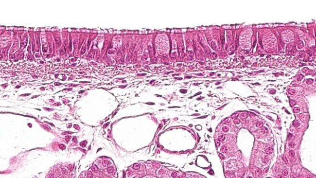 Figura 1: Epitélio pseudo-estratificado ciliado com células caliciformes características do sistema respiratório.