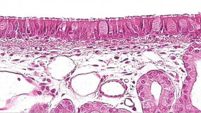 Figura 1: Epit&eacute;lio pseudo-estratificado ciliado com c&eacute;lulas caliciformes caracter&iacute;sticas do sistema respirat&oacute;rio.
