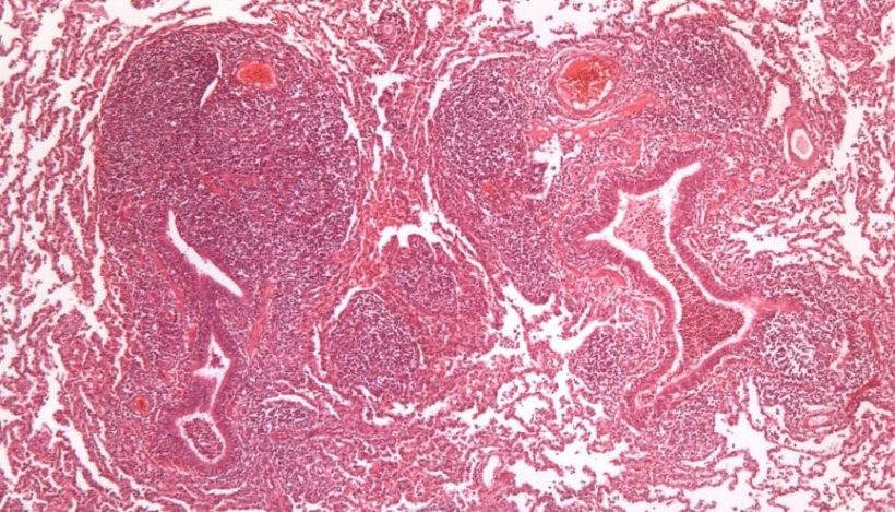 Figura 2:&nbsp;Hiperplasia do tecido linfoide peribronquiolar causada por M. hyopneumoniae.
