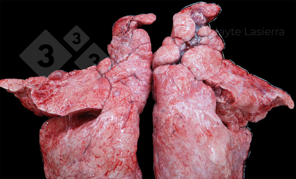 Evolução das lesões pulmonares nos últimos anos