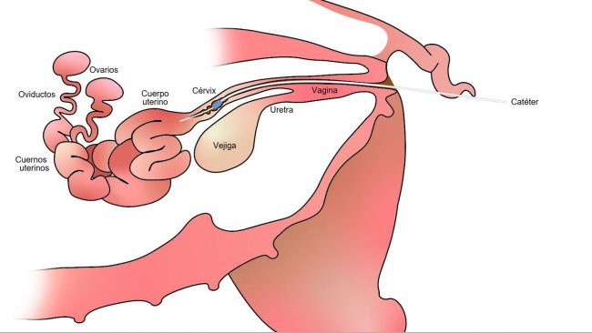 Figura 1. Com a insemina&ccedil;&atilde;o p&oacute;s-cervical, o s&ecirc;men &eacute; depositado no corpo uterino, ap&oacute;s o colo do &uacute;tero.
