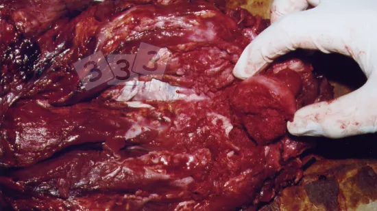 Semana de 18-Nov-2025