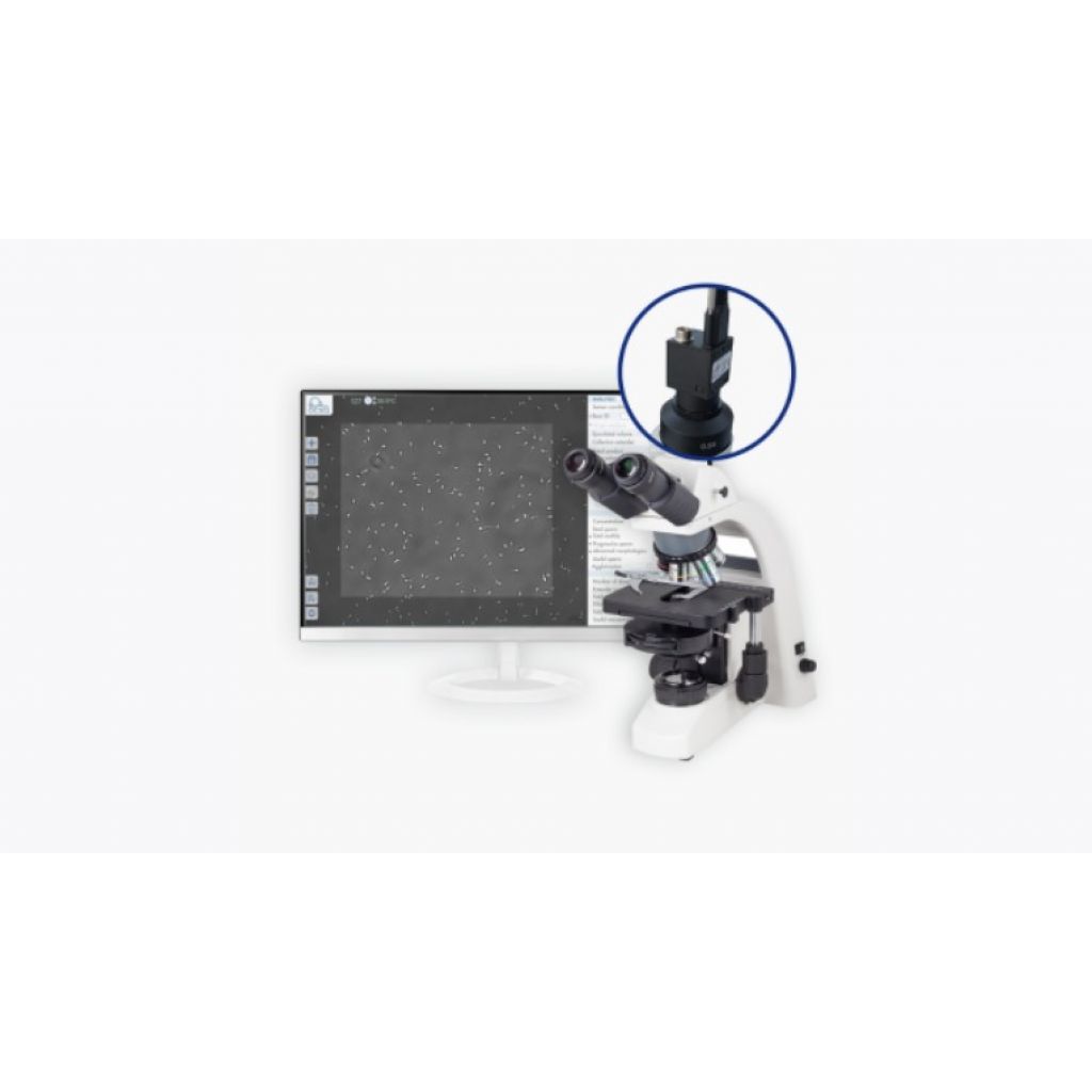 Análisis seminal - OCSA Sistema CASA de Kubus 